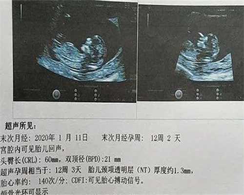 优生优育十项检查项目优生优育检查项目有哪些-优质代妈