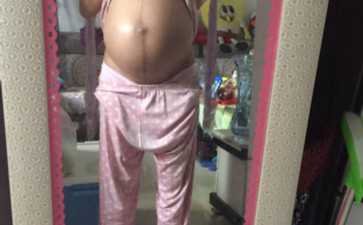 子宫肌瘤做试管婴儿成功率-子宫肌瘤适合做试管吗
