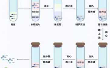 睾丸穿刺取精手术需不需要住院-睾丸穿刺手术大概要多久