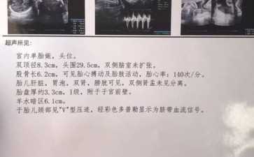 6年3次试管移植失败，我放弃了-代怀多少钱
